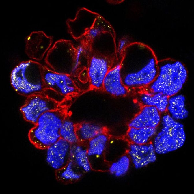 Une photo obtenue par microscopie à fluorescence qui présente des cellules assemblées sous la forme d'un amas ressemblant à une grosse fleur. Les cellules forment les pétales de la fleur.