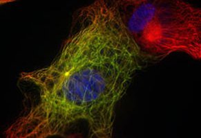 [2014-06-26] INFRv4_cellules rétiniennes, cellules souches_IAU.jpg