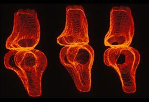 [2015-10-08] INFRv4_implant vivant, cartilage_IAU.jpg