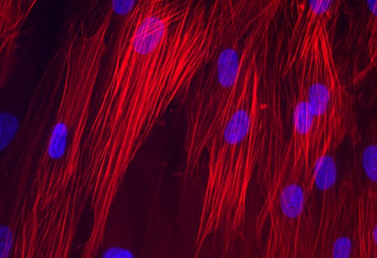 cellules différenciées en myofibroblastes sous l’action du facteur de croissance